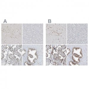Anti-WRNIP1 antibody produced in rabbit 