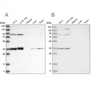 Anti-WRNIP1 antibody produced in rabbit 