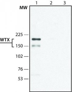 Anti-WTX (C-terminal) antibody produced in rabbit 