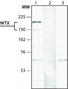 Anti-WTX (N-terminal) antibody produced in rabbit 