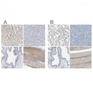 Anti-XIRP1 antibody produced in rabbit 