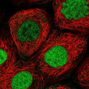 Anti-XPO5 antibody produced in rabbit 