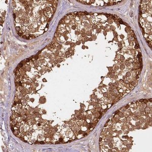 Anti-XPR1 antibody produced in rabbit 