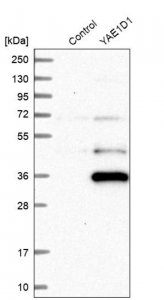 Anti-YAE1D1 antibody produced in rabbit 