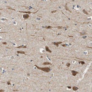 Anti-YAE1D1 antibody produced in rabbit 