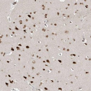 Anti-YAF2 antibody produced in rabbit 