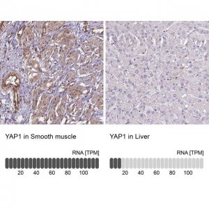 Anti-YAP1 