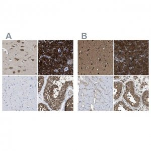 Anti-YARS antibody produced in rabbit 