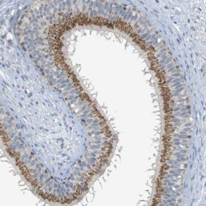 Anti-YIPF3 antibody produced in rabbit 