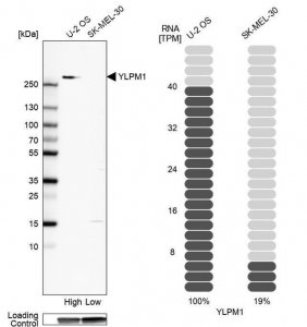 Anti-YLPM1 antibody produced in rabbit HPA061123-100UL