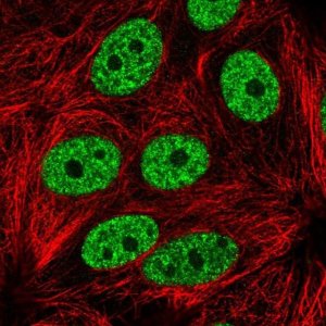 Anti-YLPM1 antibody produced in rabbit HPA061123-100UL