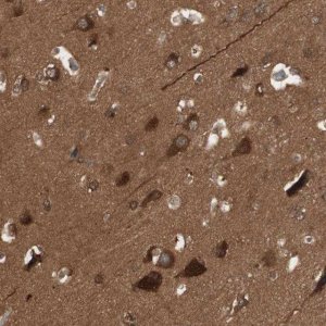 Anti-YWHAB antibody produced in rabbit 
