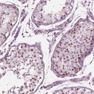 Anti-YY2 antibody produced in rabbit 