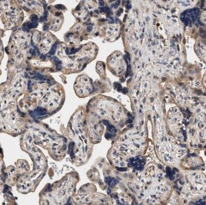 Anti-ZADH2 antibody produced in rabbit 