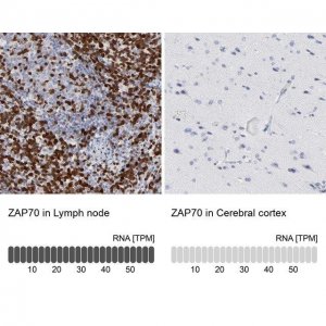 Anti-ZAP70 antibody produced in rabbit 