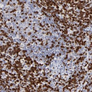 Anti-ZAP70 antibody produced in rabbit 