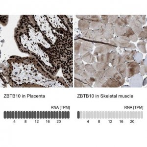Anti-ZBTB10 antibody produced in rabbit 
