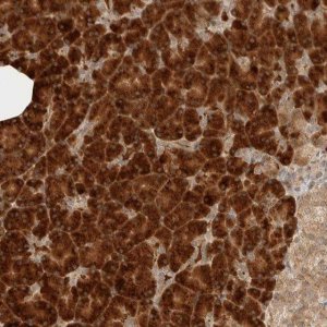 Anti-ZBTB2 antibody produced in rabbit 