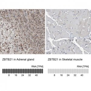 Anti-ZBTB21 antibody produced in rabbit 