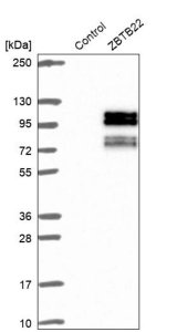 Anti-ZBTB22 antibody produced in rabbit 