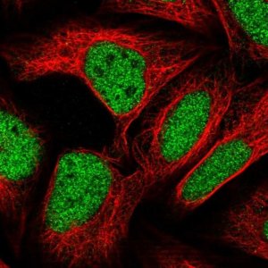 Anti-ZBTB22 antibody produced in rabbit 