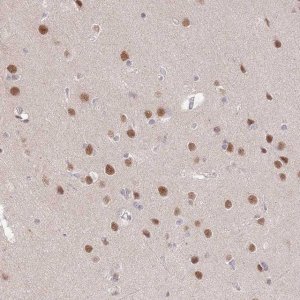 Anti-ZBTB7A antibody produced in rabbit 