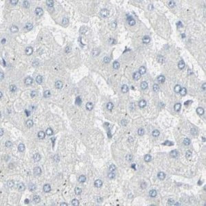 Anti-ZBTB7B antibody produced in rabbit 