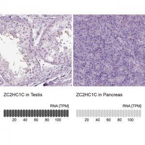 Anti-ZC2HC1C 