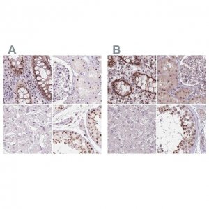 Anti-ZC3H14 antibody produced in rabbit 