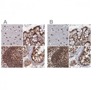 Anti-ZC3H18 antibody produced in rabbit 