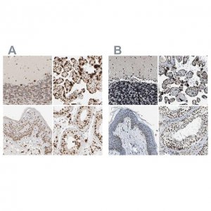 Anti-ZC3HC1 antibody produced in rabbit 