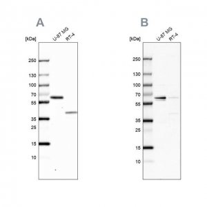 Anti-ZC3HC1 antibody produced in rabbit 