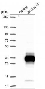 Anti-ZCCHC10 antibody produced in rabbit 