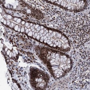 Anti-ZCCHC10 antibody produced in rabbit 