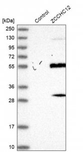 Anti-ZCCHC12 antibody produced in rabbit HPA031016-100UL