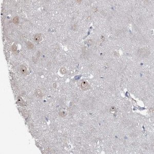 Anti-ZCCHC12 antibody produced in rabbit HPA031016-100UL