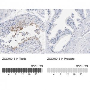 Anti-ZCCHC13 antibody produced in rabbit HPA003382-100UL
