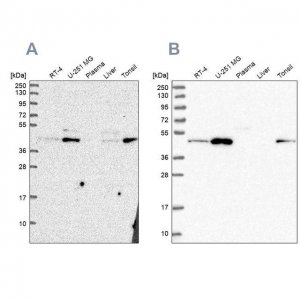 Anti-ZDHHC16 antibody produced in rabbit 