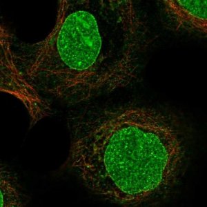 Anti-ZDHHC16 antibody produced in rabbit 