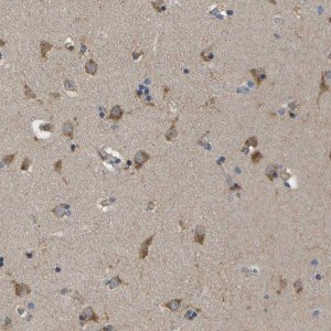 Anti-ZDHHC17 antibody produced in rabbit 