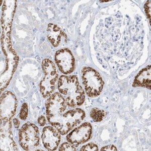 Anti-ZDHHC4 antibody produced in rabbit 