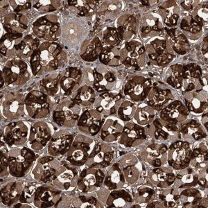 Anti-ZDHHC9 antibody produced in rabbit 