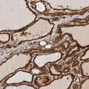 Anti-ZFAND1 antibody produced in rabbit 