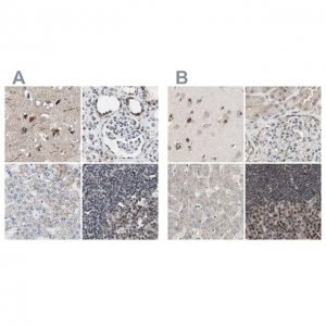 Anti-ZHX2 antibody produced in rabbit 