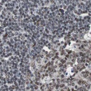 Anti-ZHX2 antibody produced in rabbit 