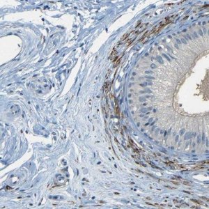 Anti-ZMAT1 antibody produced in rabbit 