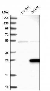 Anti-ZMAT5 antibody produced in rabbit HPA004858-100UL