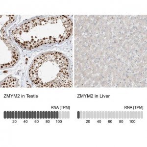 Anti-ZMYM2 antibody produced in rabbit 