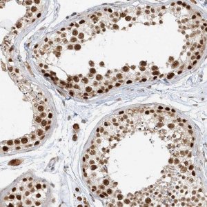 Anti-ZMYM2 antibody produced in rabbit 