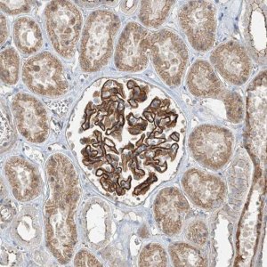 Anti-ZNF16 antibody produced in rabbit 